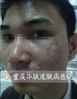 陈先生来院治疗前症状图