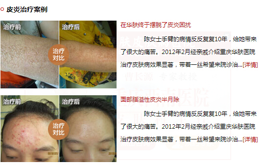 重庆华肤医院启用费用评估系统 解决患者最关心的问题