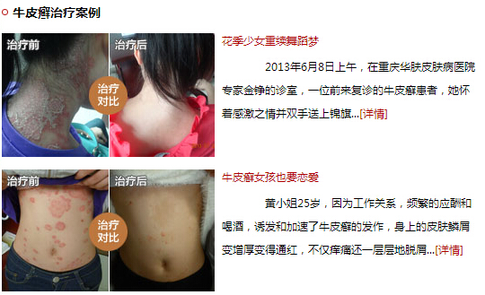 万州皮肤病医院在哪里