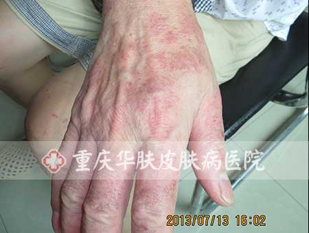 万州皮肤科医院