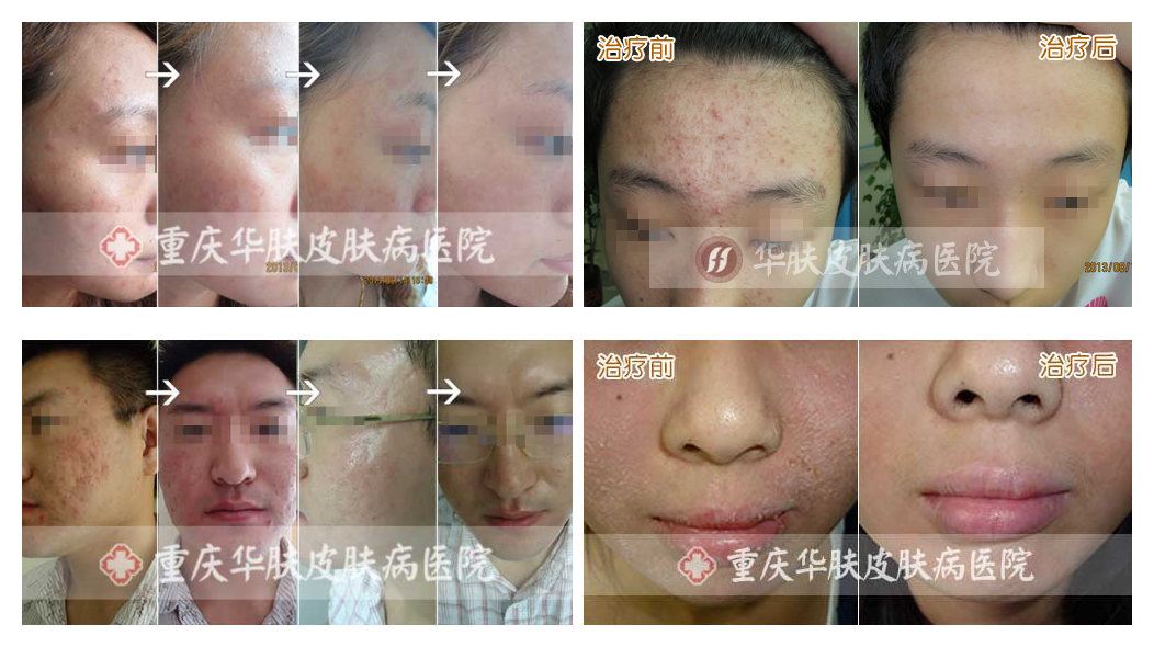 重庆皮肤病医院_皮肤科_预约挂号