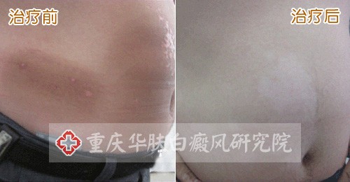 重庆皮肤病医院_皮肤科_预约挂号