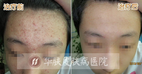重庆皮肤病医院_皮肤科_预约挂号