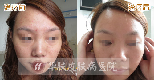 重庆皮肤病医院_皮肤科_预约挂号