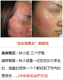 重庆华肤医院治疗皮肤病吗