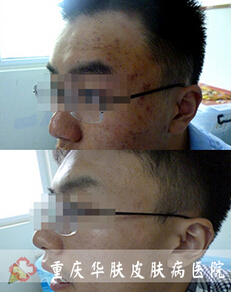 重庆皮肤病医院_皮肤科_预约挂号