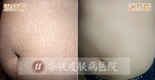 重庆皮肤病医院_皮肤科_预约挂号