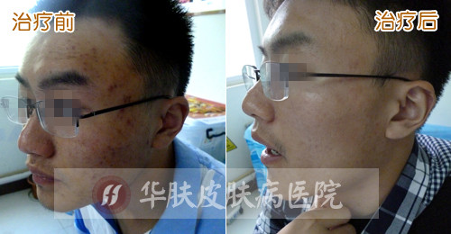 重庆皮肤病医院_皮肤科_预约挂号