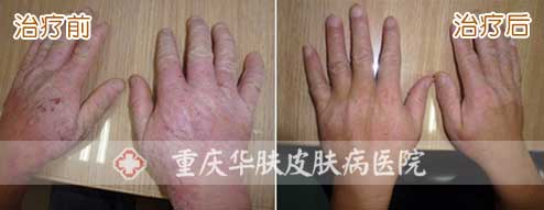 重庆皮肤病医院_皮肤科_预约挂号