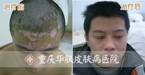 皮肤病治疗好的医院得去哪家