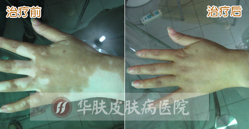 重庆皮肤病医院_皮肤科_预约挂号