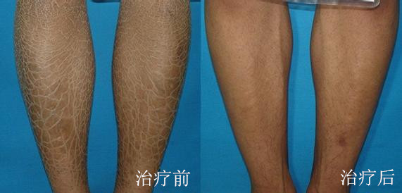 重庆有哪些知名的皮肤科医院