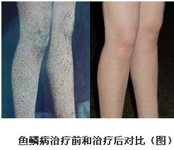 重庆皮肤病医院_皮肤科_预约挂号