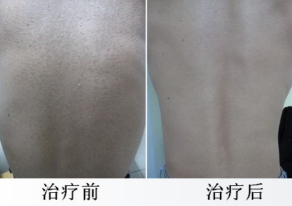 重庆皮肤病医院_皮肤科_预约挂号