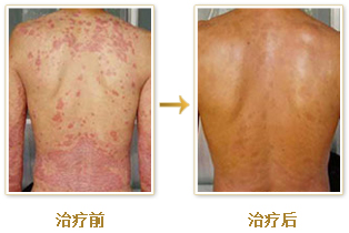 重庆皮肤病医院_皮肤科_预约挂号