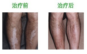 重庆皮肤病医院_皮肤科_预约挂号