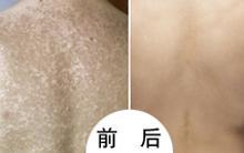 重庆皮肤病医院_皮肤科_预约挂号