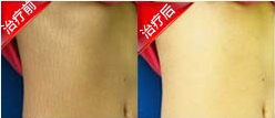 重庆皮肤病医院_皮肤科_预约挂号