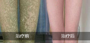 重庆皮肤病医院_皮肤科_预约挂号