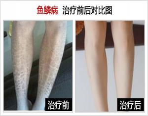 重庆皮肤病医院_皮肤科_预约挂号