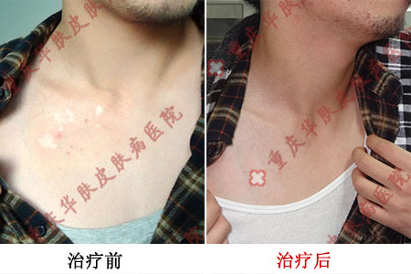 重庆皮肤病医院_皮肤科_预约挂号