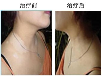 重庆皮肤病医院_皮肤科_预约挂号