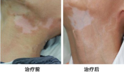 重庆皮肤病医院_皮肤科_预约挂号