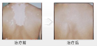 重庆皮肤病医院_皮肤科_预约挂号
