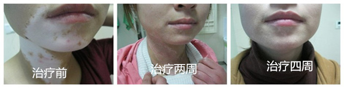 重庆皮肤病医院_皮肤科_预约挂号