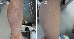 重庆皮肤病医院_皮肤科_预约挂号