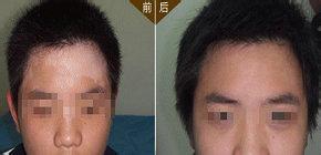 重庆皮肤病医院_皮肤科_预约挂号