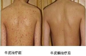 重庆皮肤病医院_皮肤科_预约挂号
