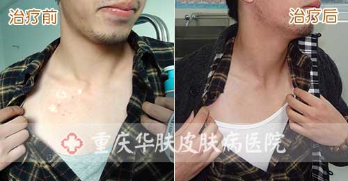 重庆皮肤病医院_皮肤科_预约挂号