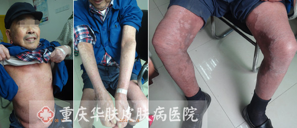 重庆皮肤病医院_皮肤科_预约挂号