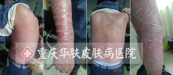 重庆皮肤病医院_皮肤科_预约挂号