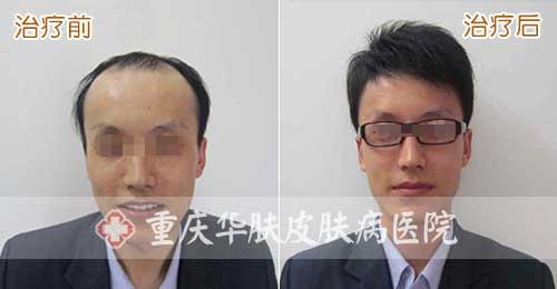 重庆皮肤病医院_皮肤科_预约挂号