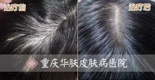 重庆皮肤病医院_皮肤科_预约挂号