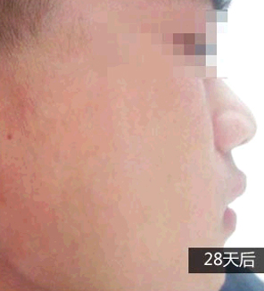 重庆皮肤病医院_皮肤科_预约挂号