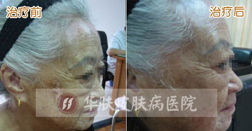 九龙坡哪家皮肤科医院最好