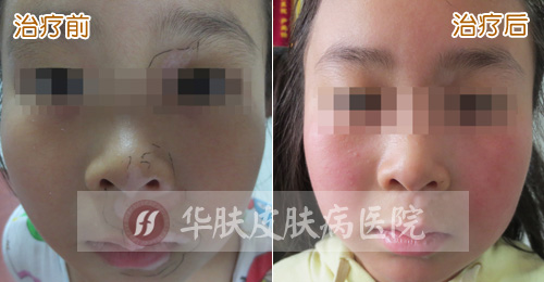 重庆皮肤病医院_皮肤科_预约挂号