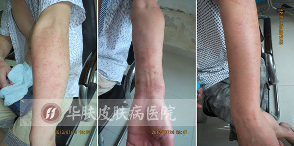 重庆皮肤病医院_皮肤科_预约挂号