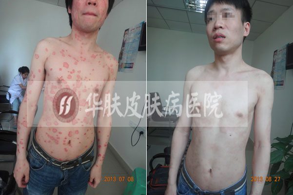 重庆皮肤病医院_皮肤科_预约挂号