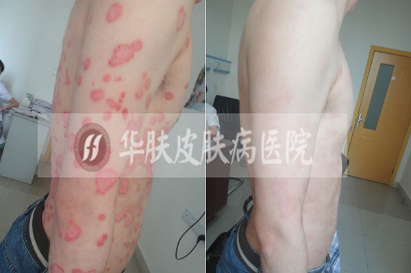 重庆皮肤病医院_皮肤科_预约挂号