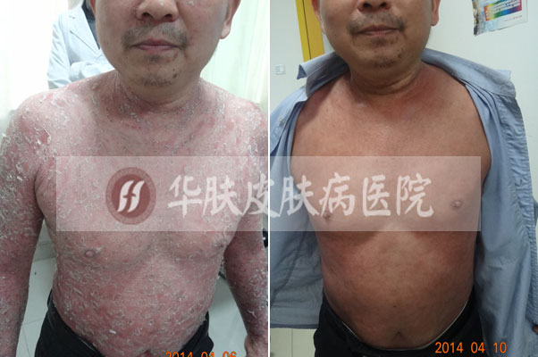 重庆皮肤病医院_皮肤科_预约挂号