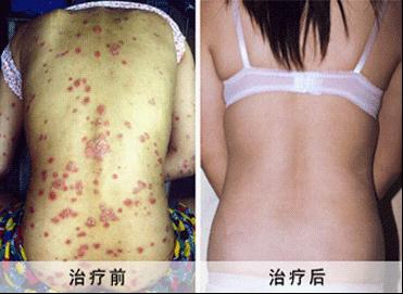 重庆华肤医院好不好