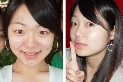 重庆皮肤病医院