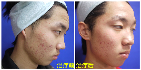 重庆华肤医院怎么样有人去看过吗