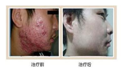 重庆最好的皮肤科医院在哪啊
