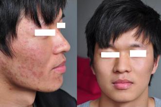 看皮肤病重庆华肤医院正规吗