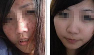 重庆皮肤科医院